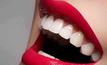 dentes brancos